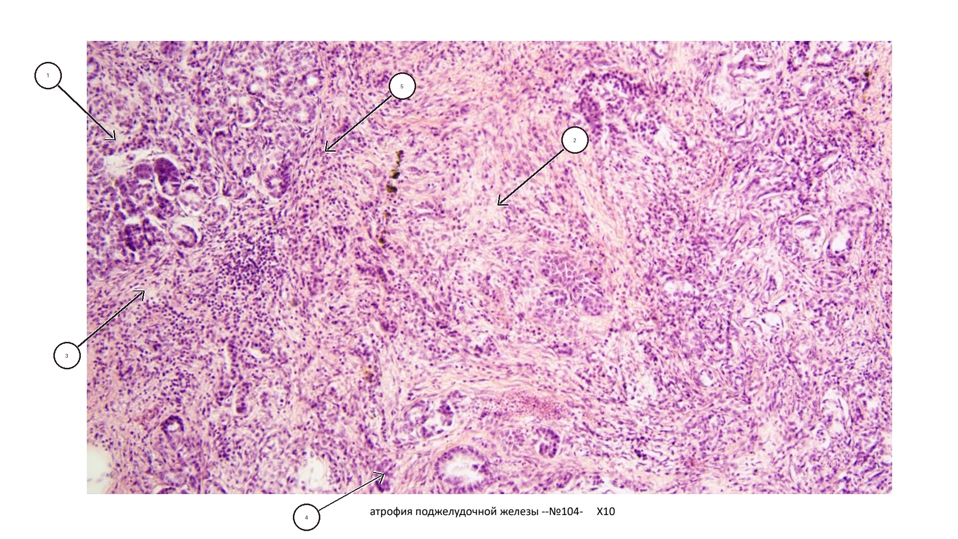patan01-104-foto-marks.jpg