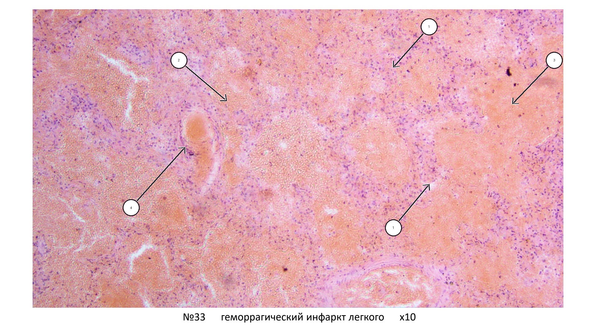 patan01-33-foto-marks.jpg