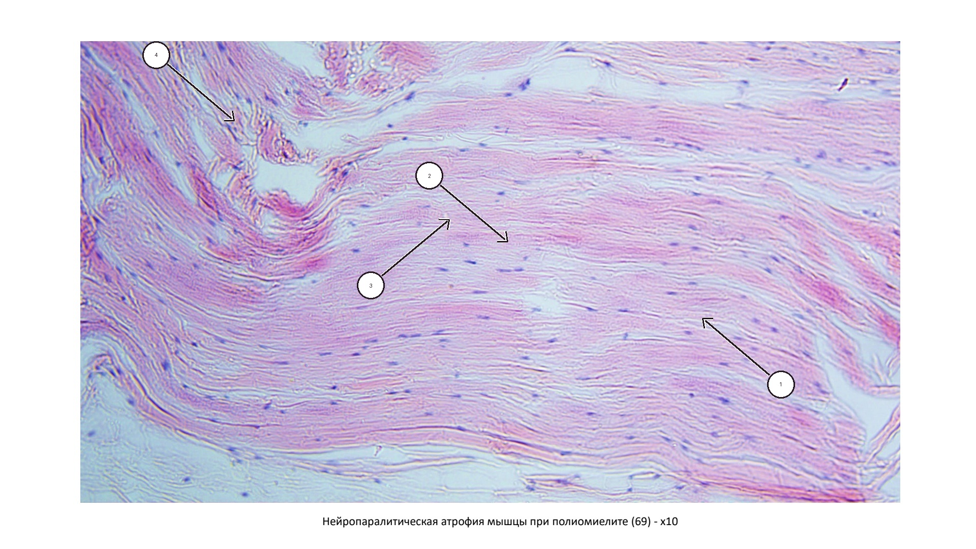 patan01-69-foto-marks.jpg