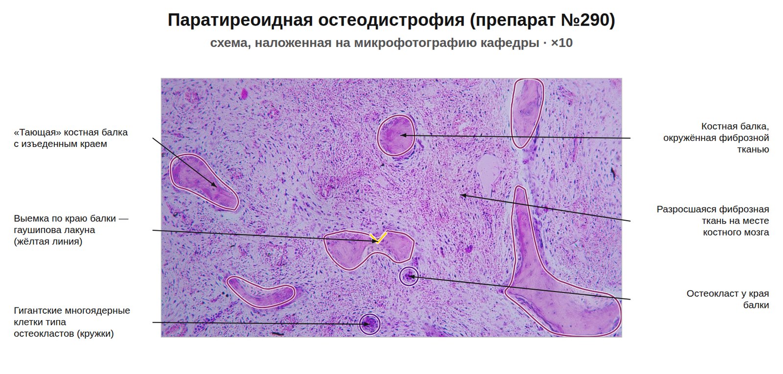 patan05-290-nalozhenie.jpg