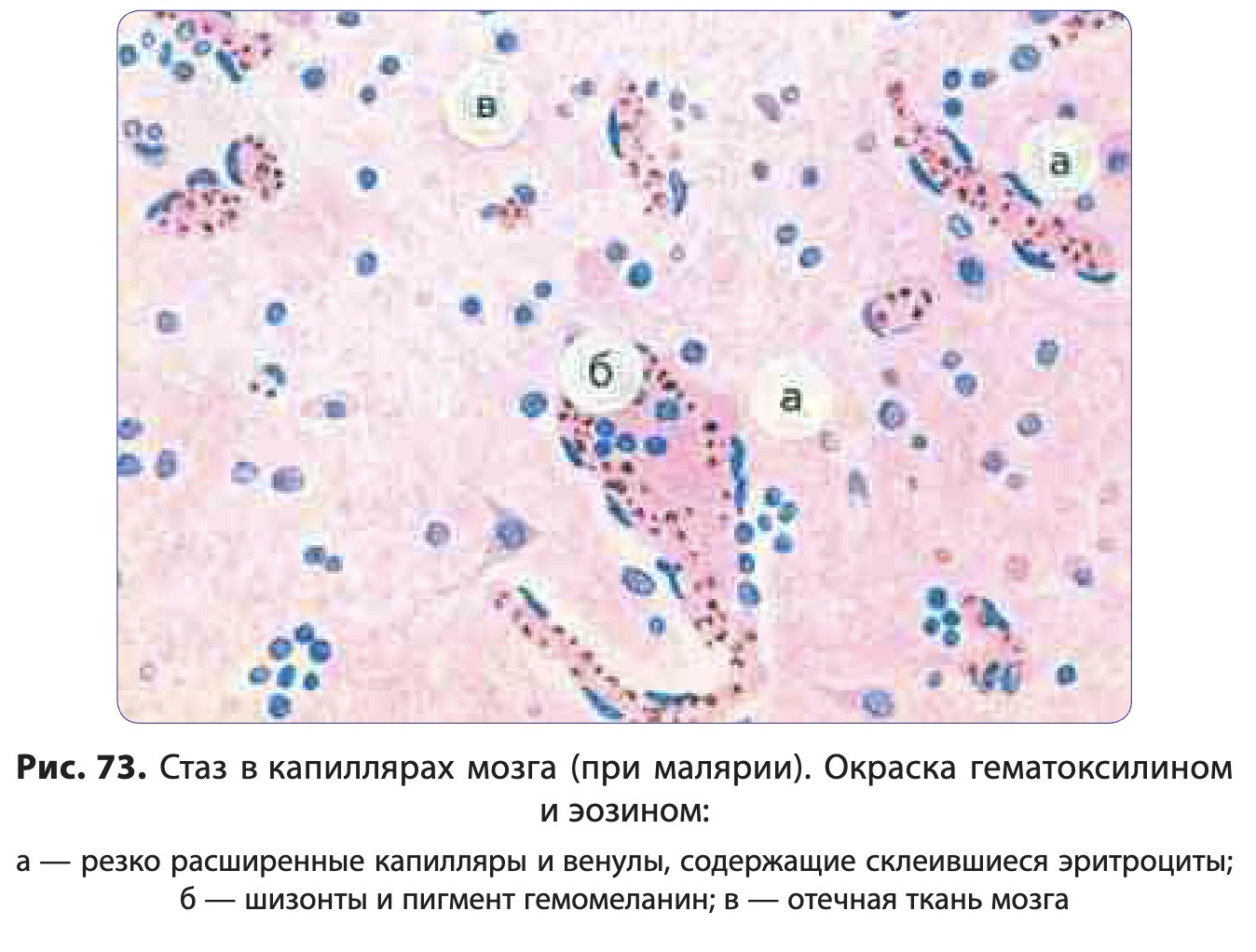 patan06-paukov-73.jpg