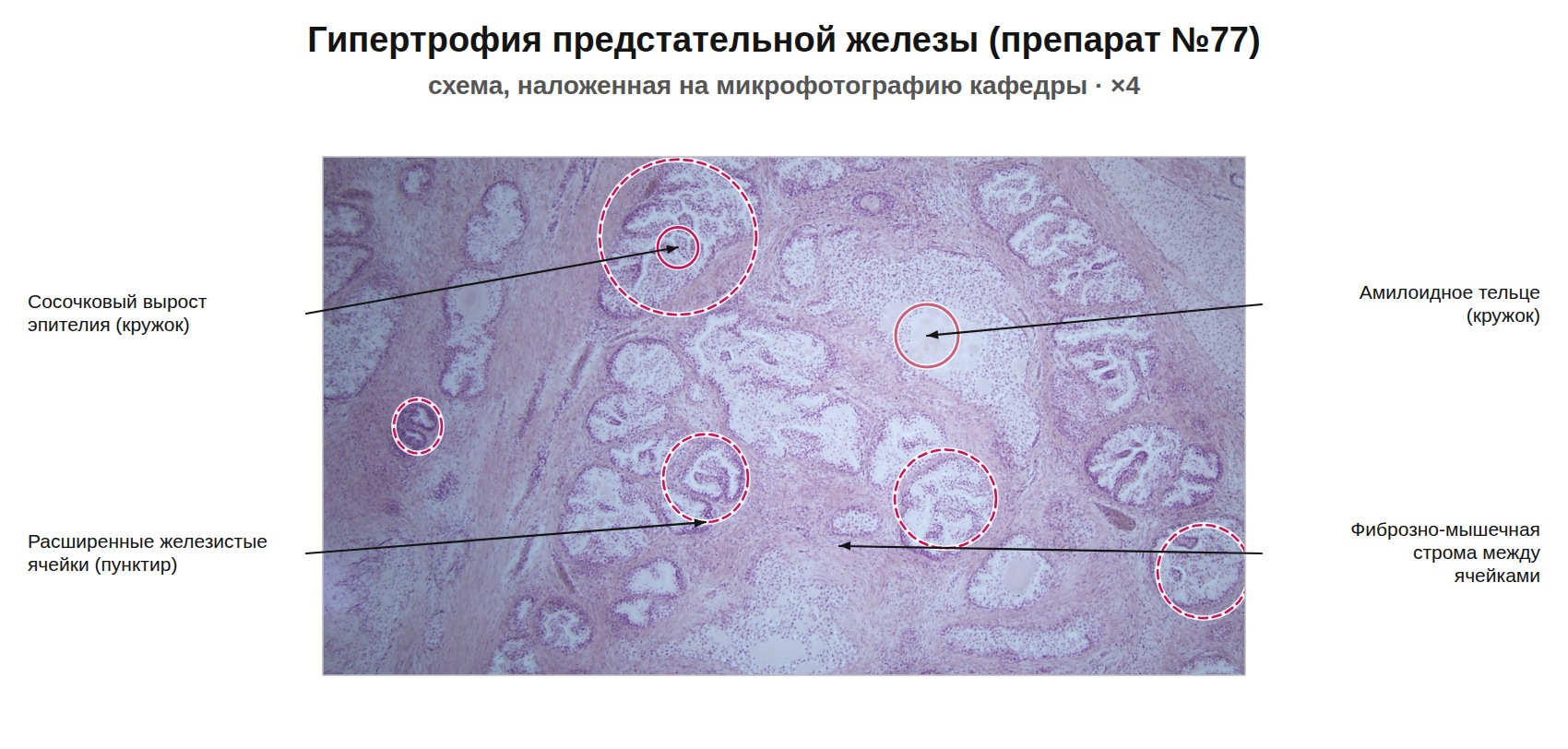 patan07-77-nalozhenie.jpg